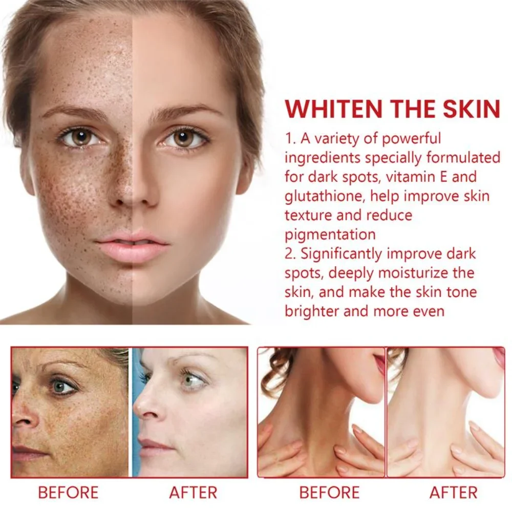 Dark Spot Remover Cream Whitening Body Lotion Lighten Melanin Repair Dull Fast Brightening Skin Care Korean Cosmetics