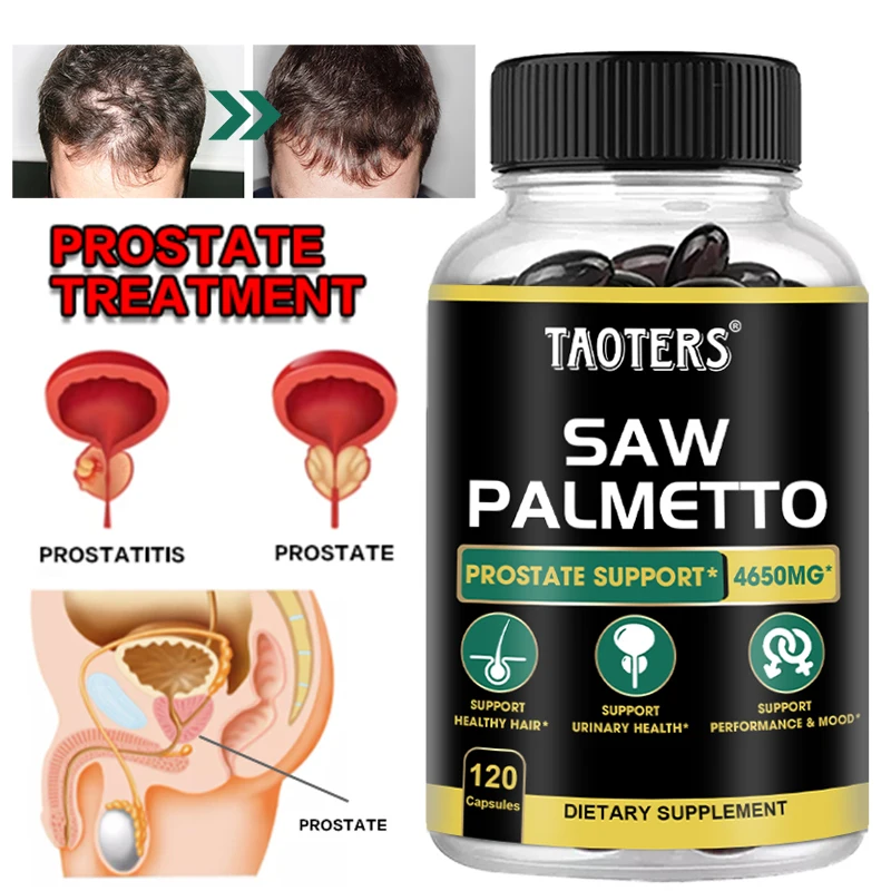 Saw Palmetto Supplement Saw Palmetto Capsules Men Prostate Health Supplement Supports Urinary Tract Health Supports Bladder Promotes Hair Gro