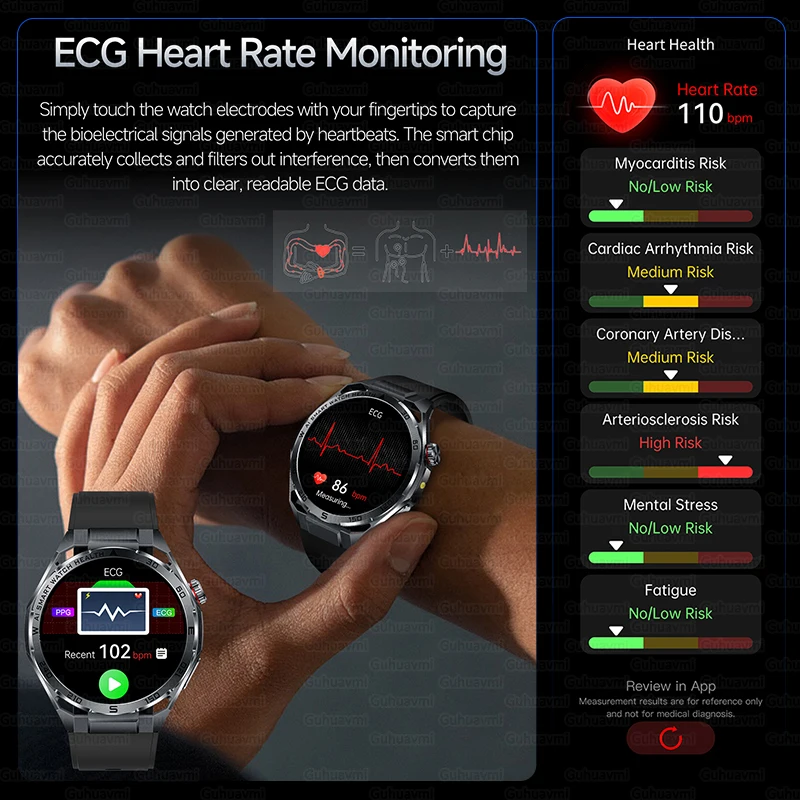 2026 New AI Health Smart Watch 1.53''AMOLED HD Screen ECG Bluetooth Call Uric Acid Blood Fat Heart Rate Monitor Sport Smartwatch 4