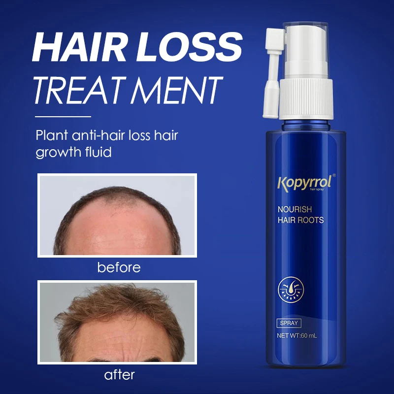 Hair Growth Spray Serum Anti Hair Loss Fast Grow Hair Essential Oil For
