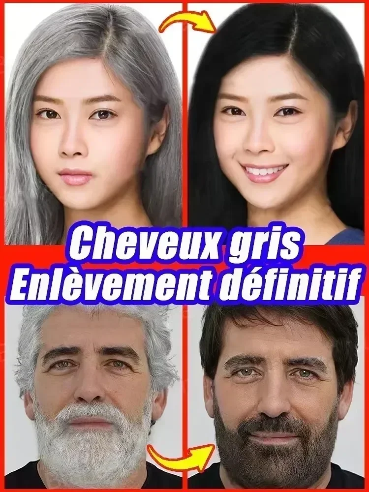 Hair Treatment Turn White Hair into Black Remove Gray Hair in 7 Days