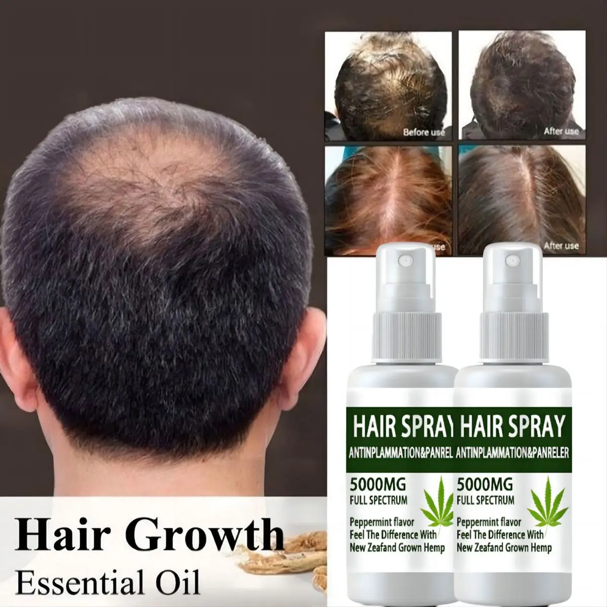 Rapid Hair Regeneration Essence Can Treat Scalp Hair Follicles Prevent Hair Loss Repair Damaged Hairand Care for Hair