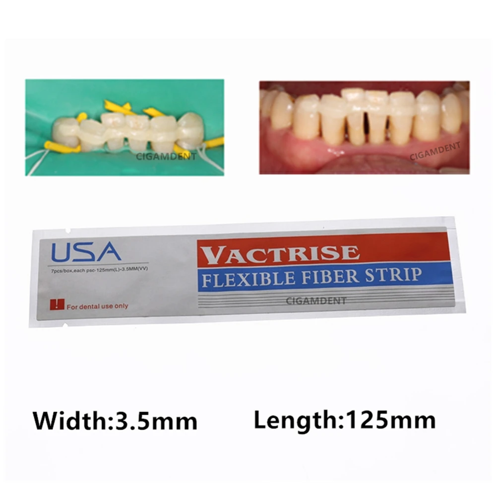 1Pc Dental Fiber Splint Glass Flexible Fiber Strip Composite Resin