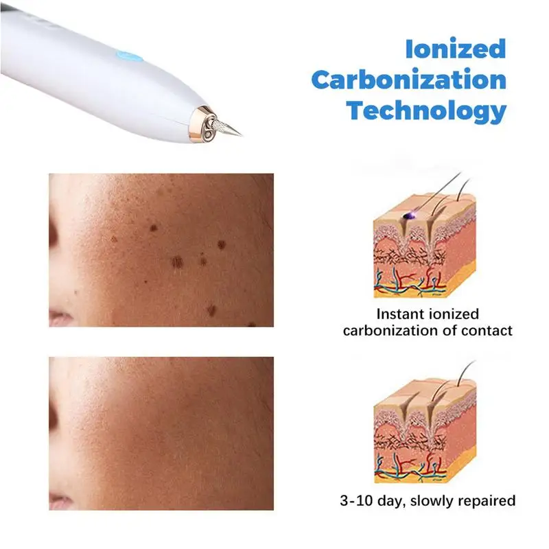 9 Level Electric Freckle Skin Mole Dark Spot Remover Pen Skin Tag Remover Dark Spot Wart Speckle Tattoo Removal Pen Plasma