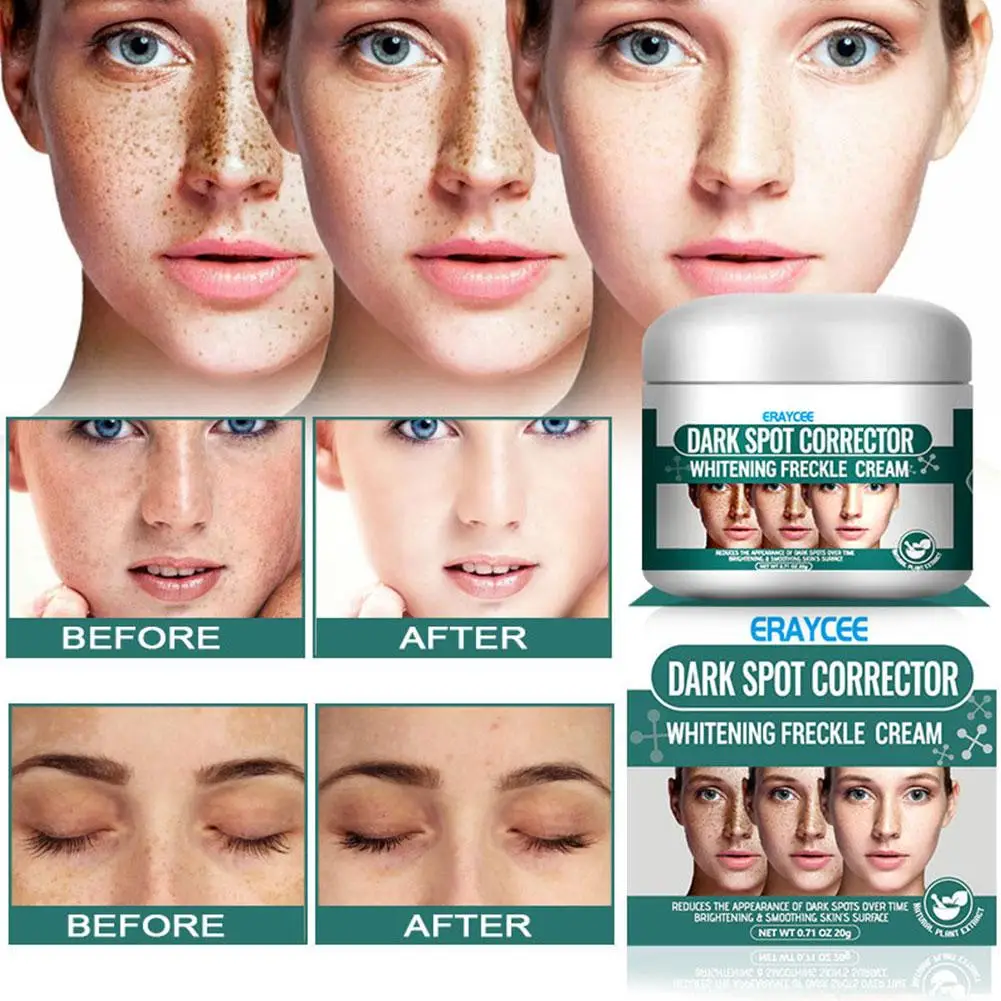 

Light Spot Cream Whitening and Freckle Cream Hydrating Repair Cream To Remove Care Moisturizing Dark Cream Skin Yellow L7M7