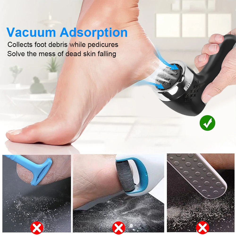  Professional Electric Feet Callus Remover,Portable  Rechargeable Foot File Pedicure Tools with Vacuum Adsorption Foot Grinder 2  Speed 3 Grinding Heads, Ideal for Dead Skin/Powerful Exfoliation : Beauty &  Personal Care