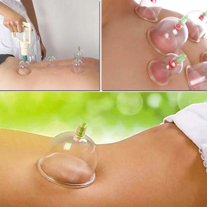 6pcs Medical Vacuum Cupping,Chinese Massage Cupping Therapy Kits with Suction Pump,Vacuum Suction Cups for Muscle Soreness 3