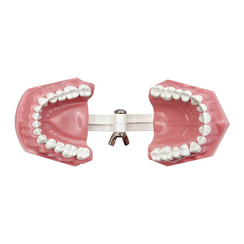 Dental Implant Education Model