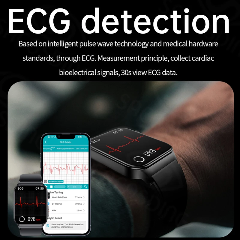 Ʈ ġ ECG   ڵ ƮϽ ƮĿ  Ʈ ð   Smartwatch