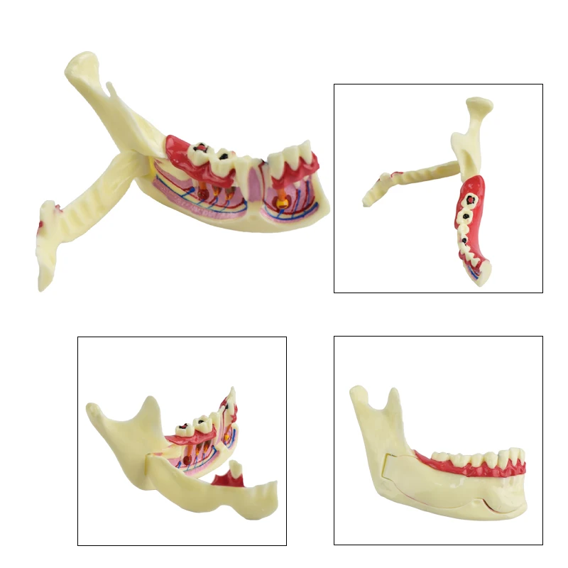 

Dental Endodontic Treatment Model Mandible Tissue Anatomical Model Anatomy of Gums Dentistry Study Oral Care Teach Teeth Model