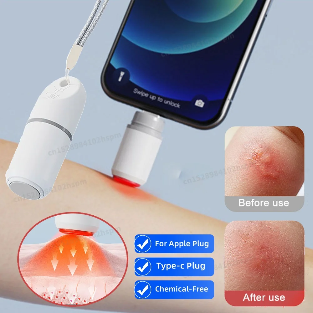 Electronic Mosquito Bite Pen 1