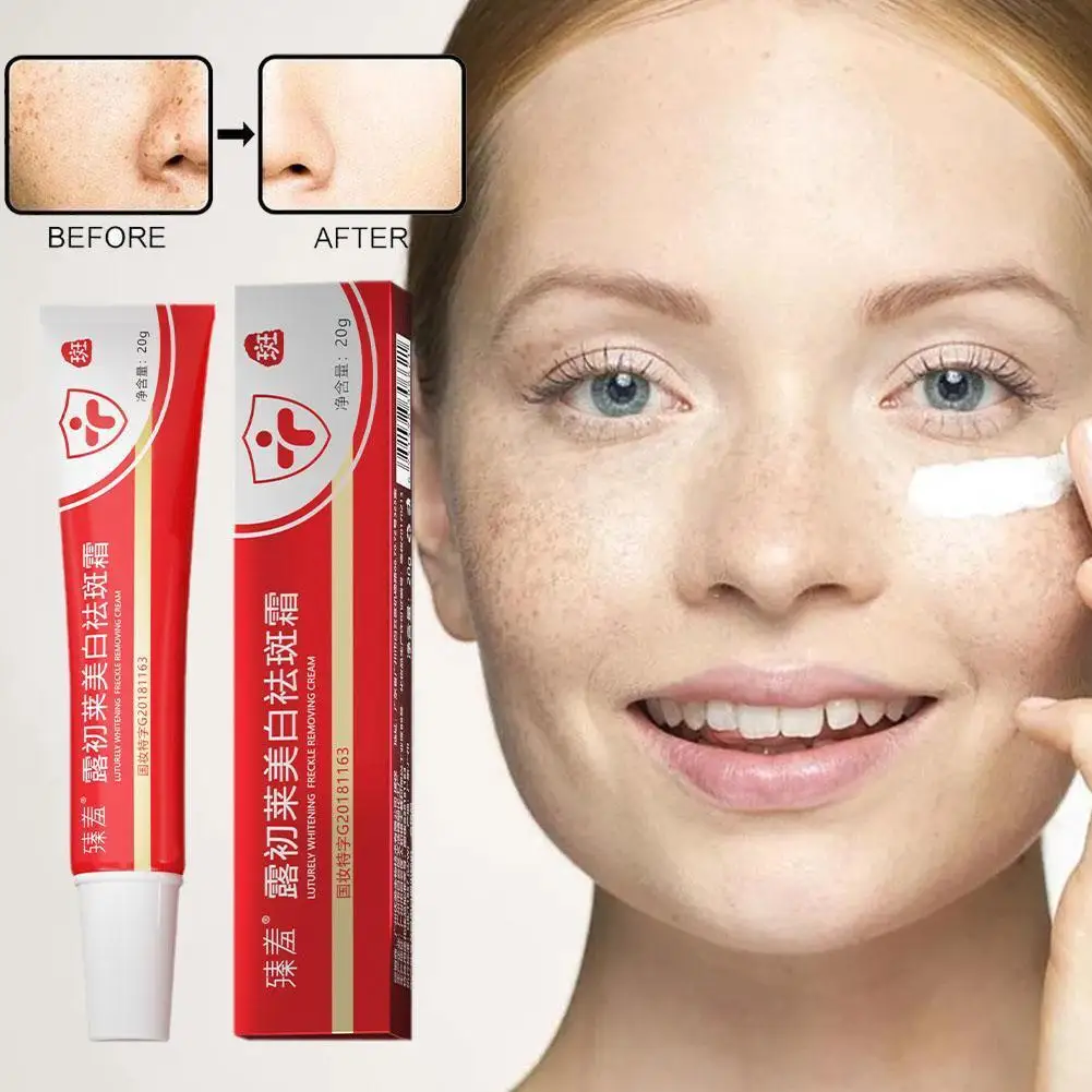 

20g Freckle Whitening Face Cream Lighten Pigmentation Dark Moisturizing Products Remover Cream Dots Care Facial Skin Melasm V3R7
