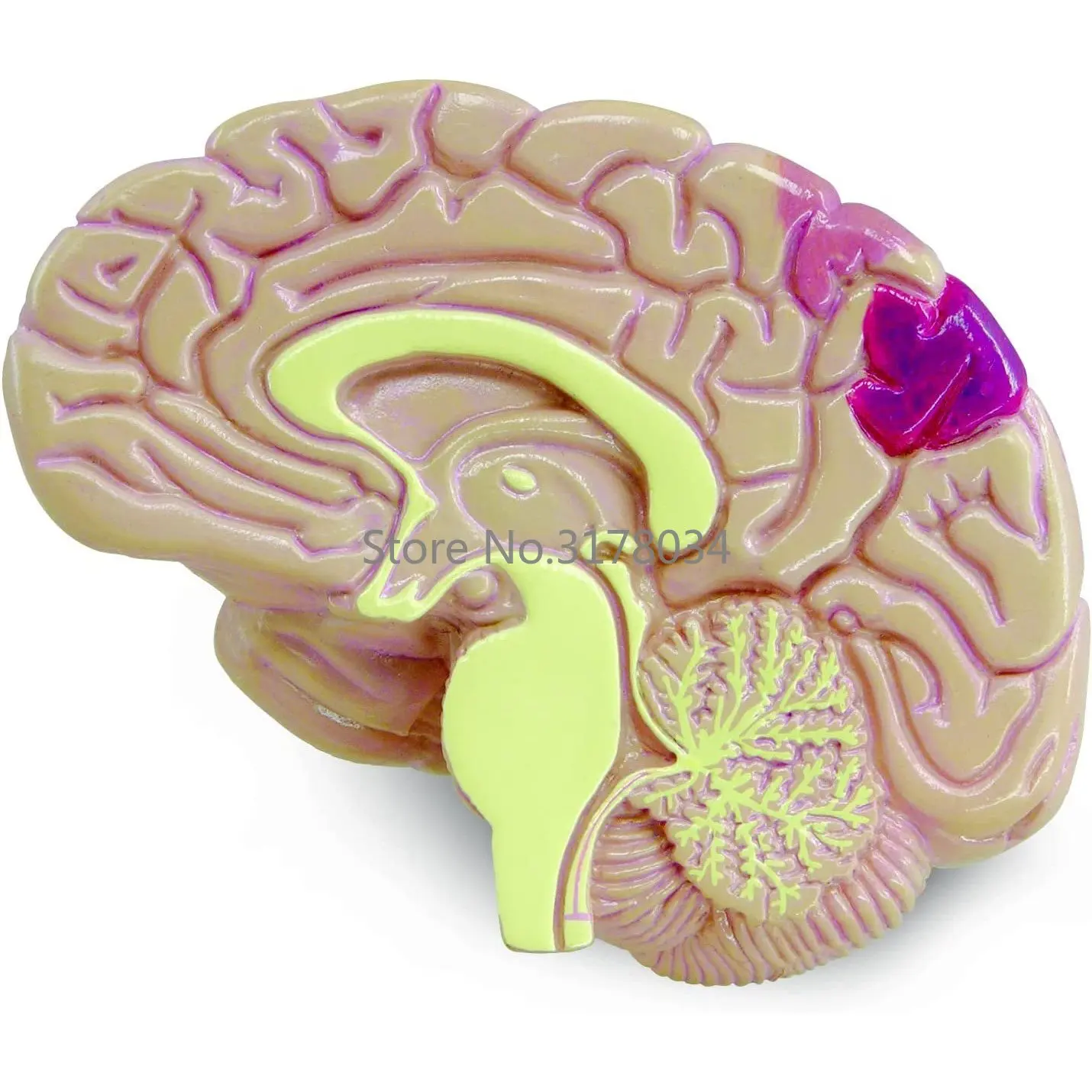 Type II Diabetes Model Set 2