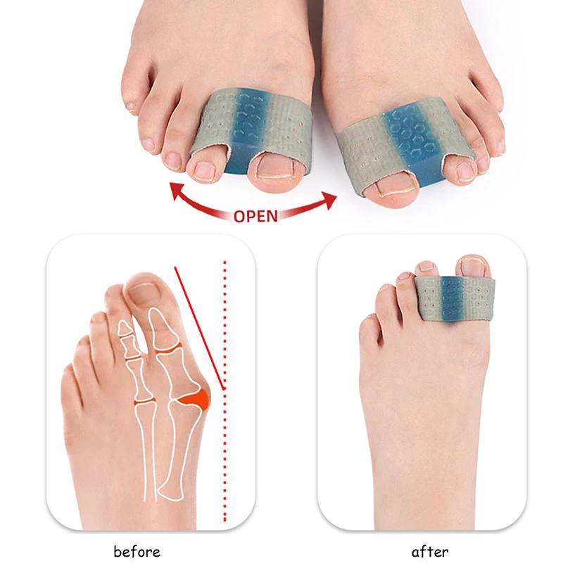

Silicone Double Toe Spreader Separator Bunion Hallux Valgus Corrector Thumb Finger Correction Straightener Foot Care Tool