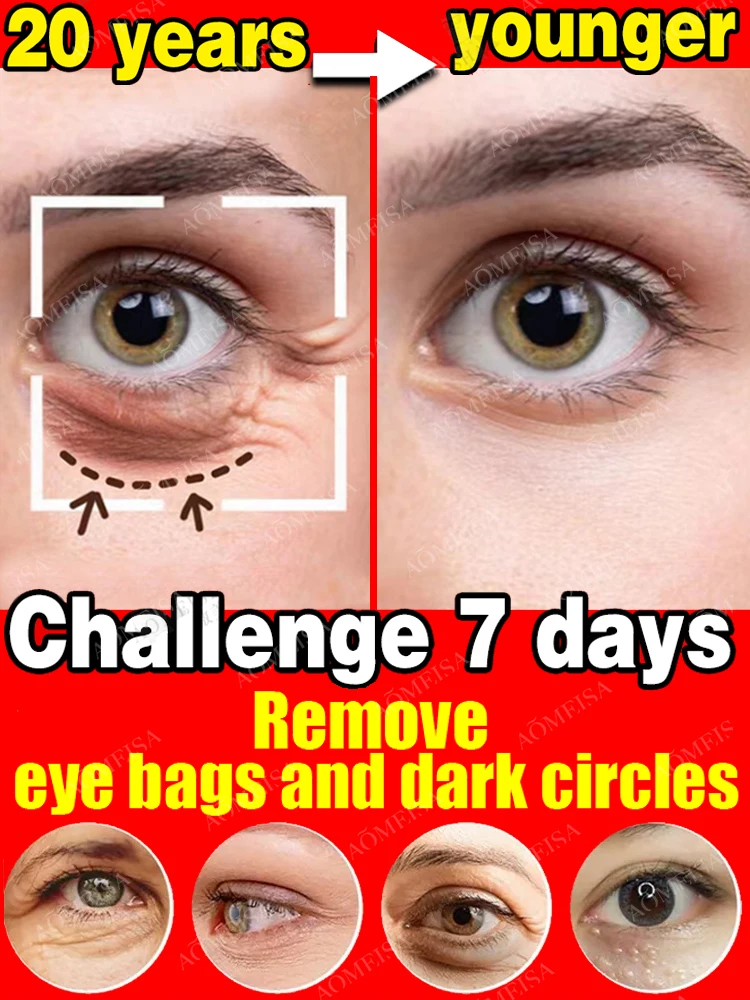 Eye Care Anti-Wrinkle Eye Cream Dark Circles Remove Eye Bags Puffy Eyes Reduce Wrinkles Fine Lines Remover Eye Fat Particles