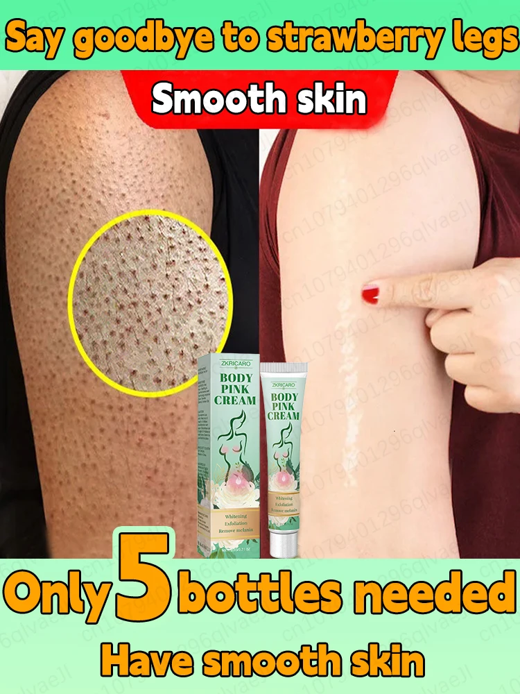 Body lotion solves strawberry legs and clears acne