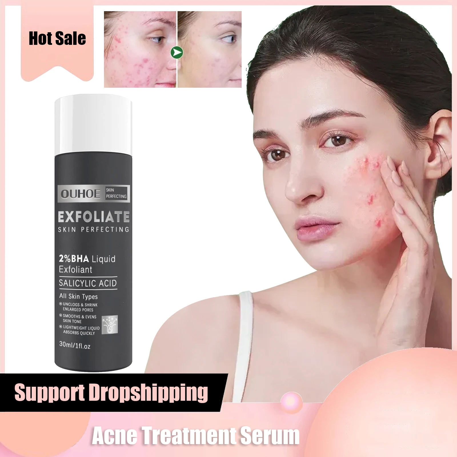 Acne Treatment Serum Ordinary Salicylic Acid Serums Remove Pimples Blackheads Anti Acne Pores