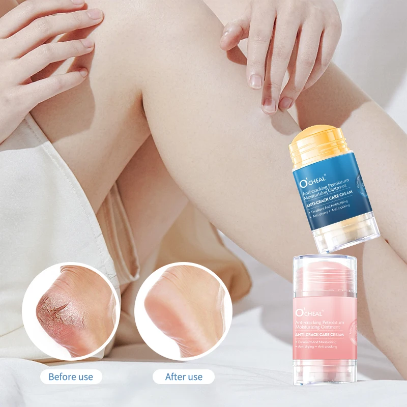 Foot Cream For Dry Cracked Feet Heels