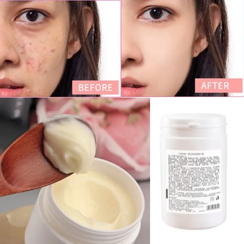 Ceramide Skin Barrier Repair Cream Facial Acne Allergy Recovery Beauty Salon Product 1000g