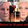 Wrinkle Remove Serum Anti-Aging Essence Fade Fine Line Lifting Firming Whitening Skin Care 1