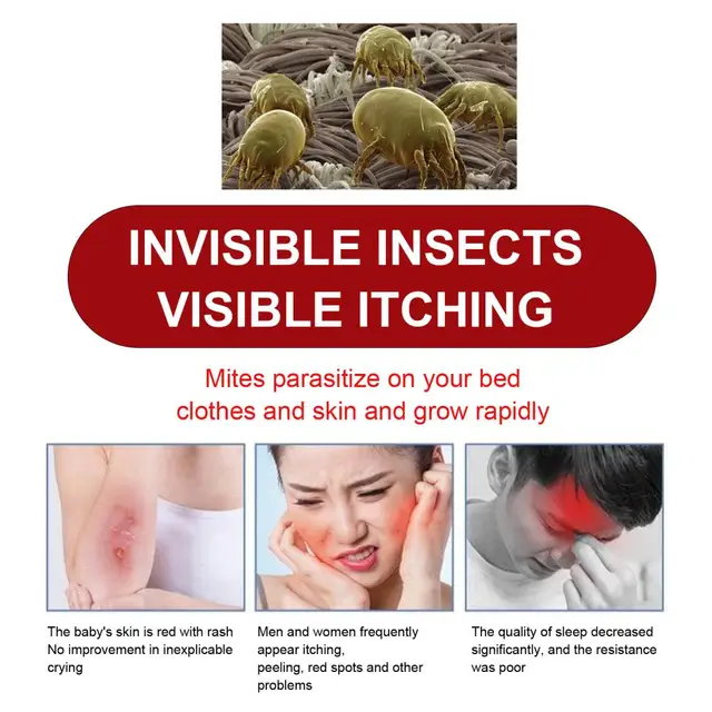 10 Táska Atka Gyilkos Por Atkák Ölése Bed -Rovar Eltávolítás Vezérlő Eltávolító Az Ágy Párnalaphoz - Image 2