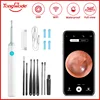 Wireless Visual Ear Endoscope Camera Ear Cleaning Tools Spoon Safe Silicone Earpick 5MP Camera Ear Wax Remover Luminous Otoscope 1
