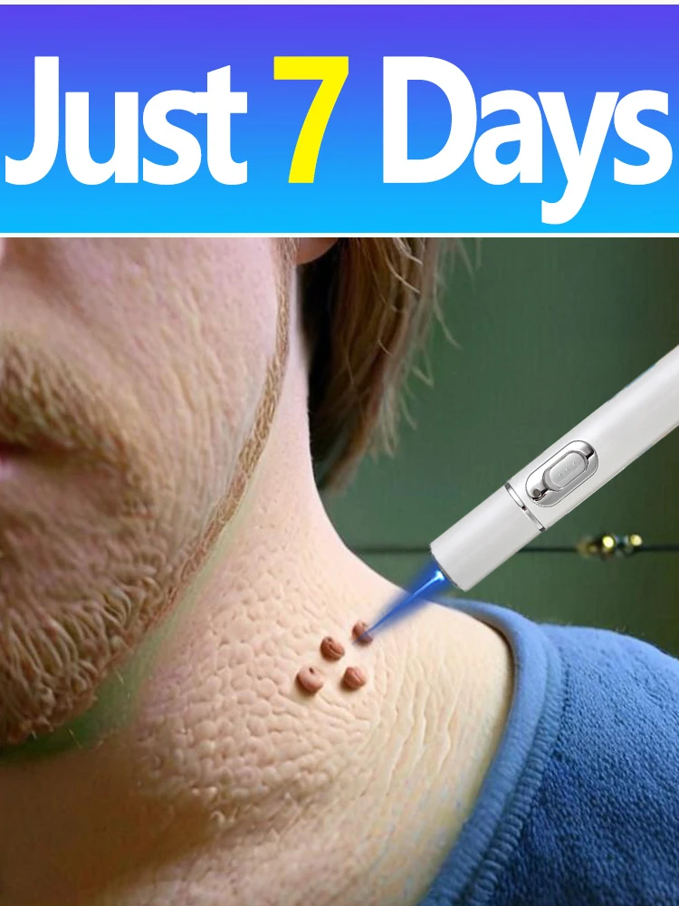 Nowymodel2025:Niebieskilaserdousuwaniabrodawek-AliExpress66