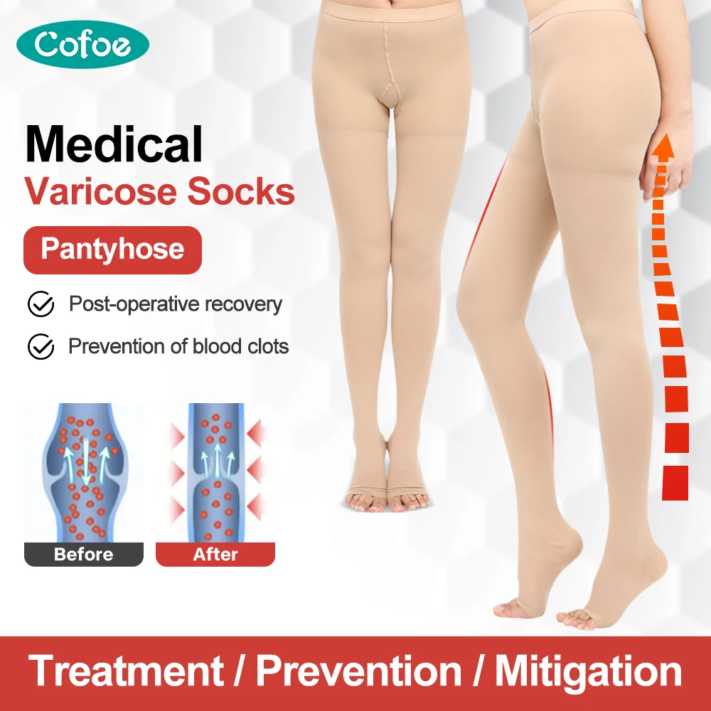 CofoeLevel1MedicalVaricoseveinStockingsElasticStockingsThighOpenToeAntithrombotic