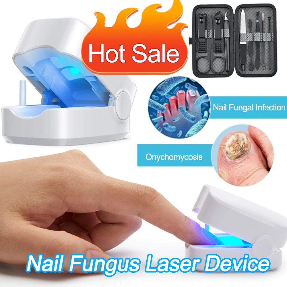 NailFungusLaserTreatmentDeviceRepairToenailFingernailFungus
