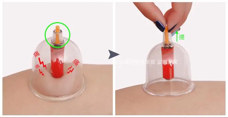 vacuum magnetic therapy of household gas type cupping apparatus can pull tanks containing joint of cupping therapy