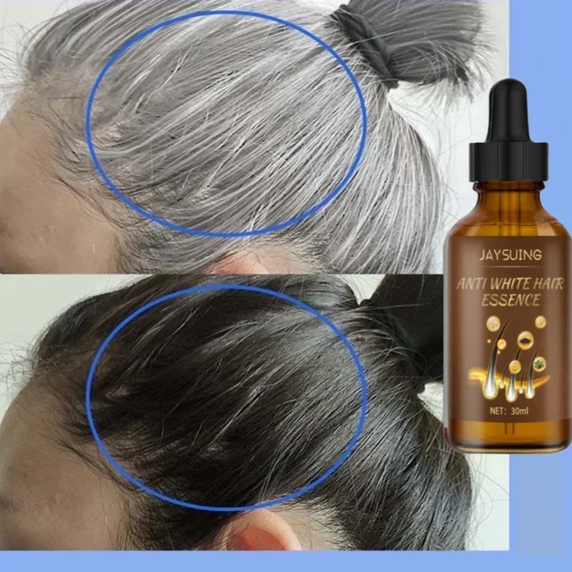 Gray White Hair Treatment Serum Liquid White To Black Natural Color Repair Nourish Product Anti Loss Hair Care Men Women