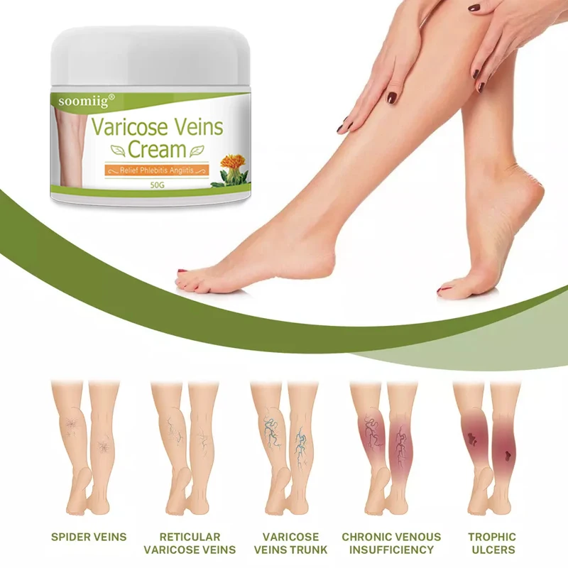 Рисунок 6 - Мазь для восстановления варикозного