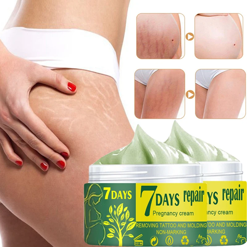 Pregnancy Repair Cream Stretch Mark Removal Removal Acne Scar Stretch