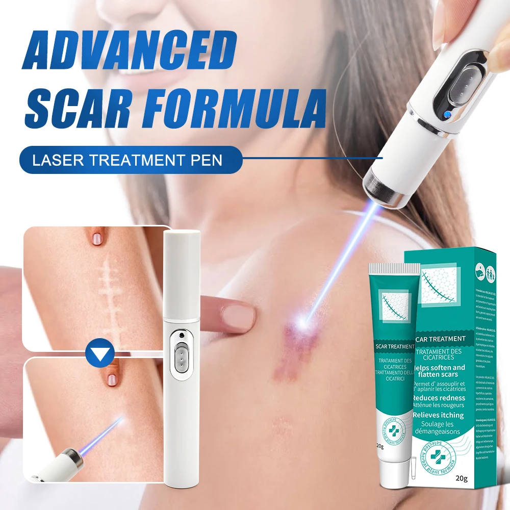 Laser Repair Skin Scars 1-7pcs Powerful Scar Removal Cream Fast Remove Deep Skin Scar Blue Light Therapy Pen Recovery Cream