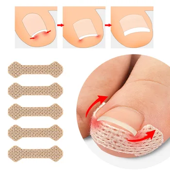 40/100pcs Adesivi per la correzione delle unghie Correttore dell'unghia del piede incarnita Patch Trattamento Recupera Correttore Strumento per la cura della pedicure 1