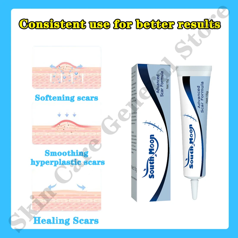Scar Removal Cream Old Scar Cream Effective Repair Old and New Scars