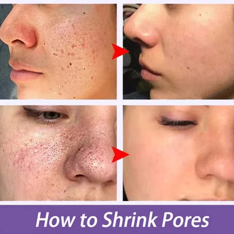 Description Picture 2 of itemFacial Remove Blackhead Rice Solid Mask Acne Blemish Black Dots Clean Face Shrink Pores Stick Cream Brighten Korean Skincare New