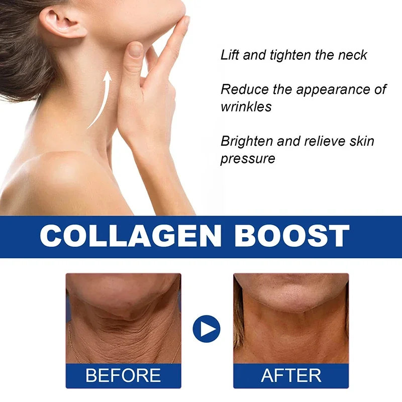 Neck Cream Eliminate Neck Lines Protein Cream Eliminate Double Chin Lift Neck Fine Lines Anti-ageing Moisturis Nourish Beauty Health