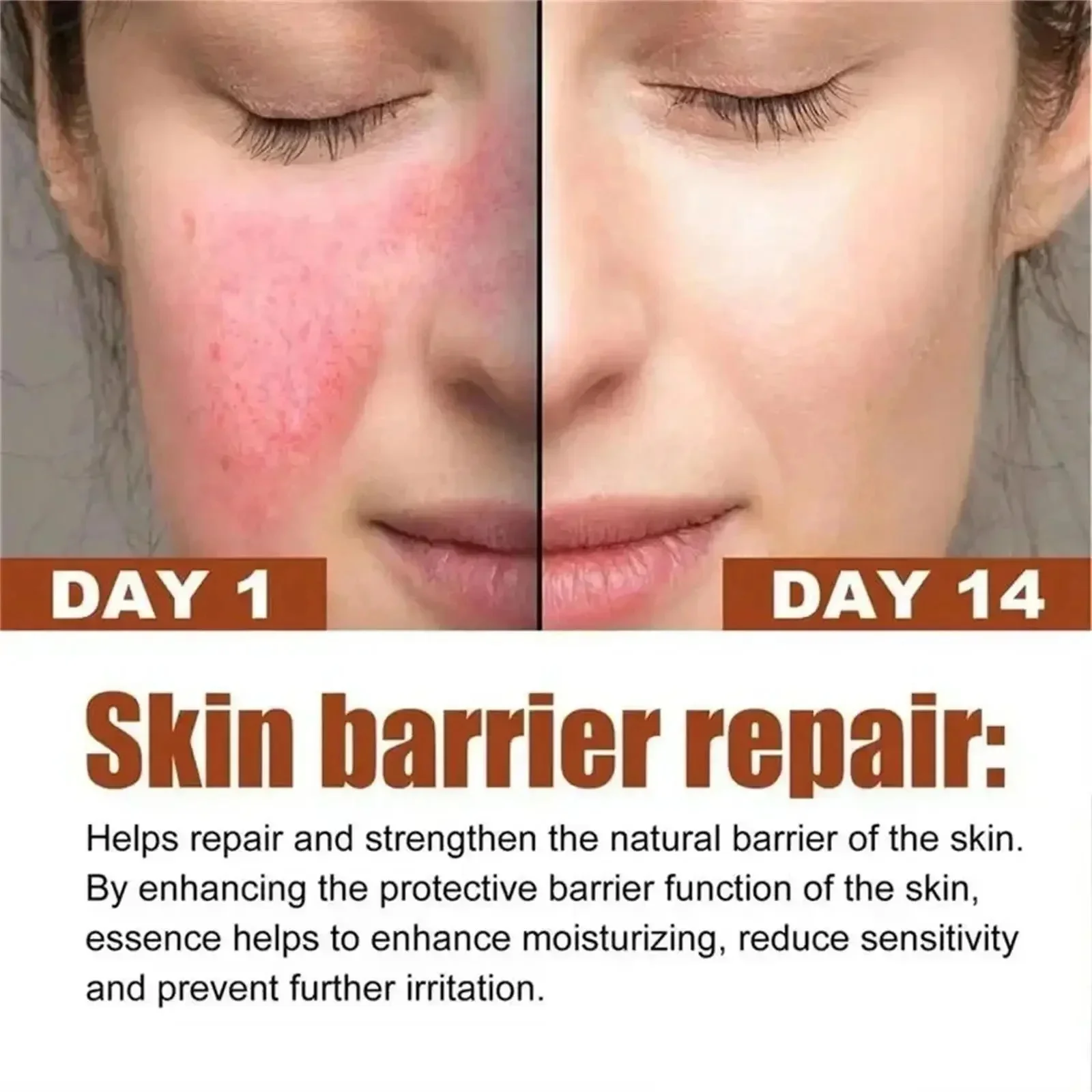 Facial Redness Relief Moisturizing Cream