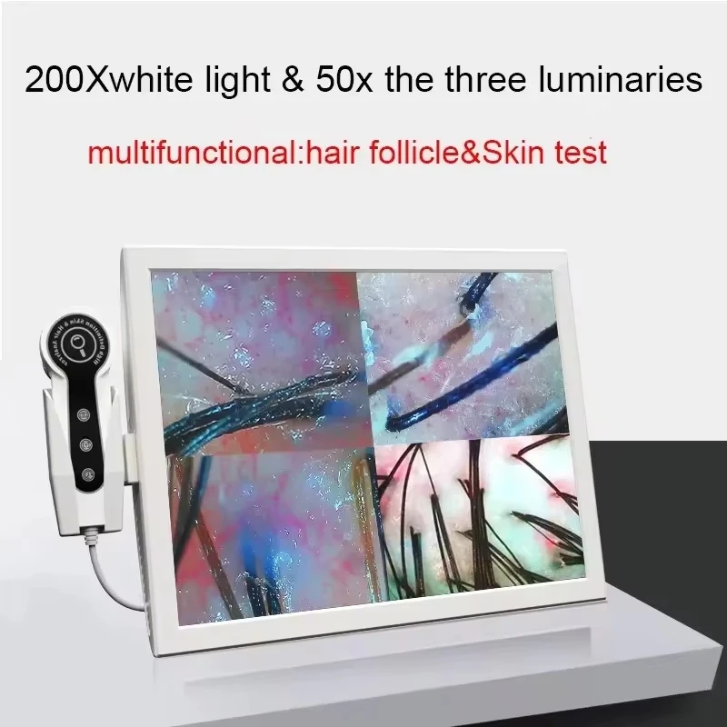 2025HD Digital Skin Analyzer Professional Hair Scalp Camera Detector Hair Follicle Oil Moisture Test Device 15inch 6