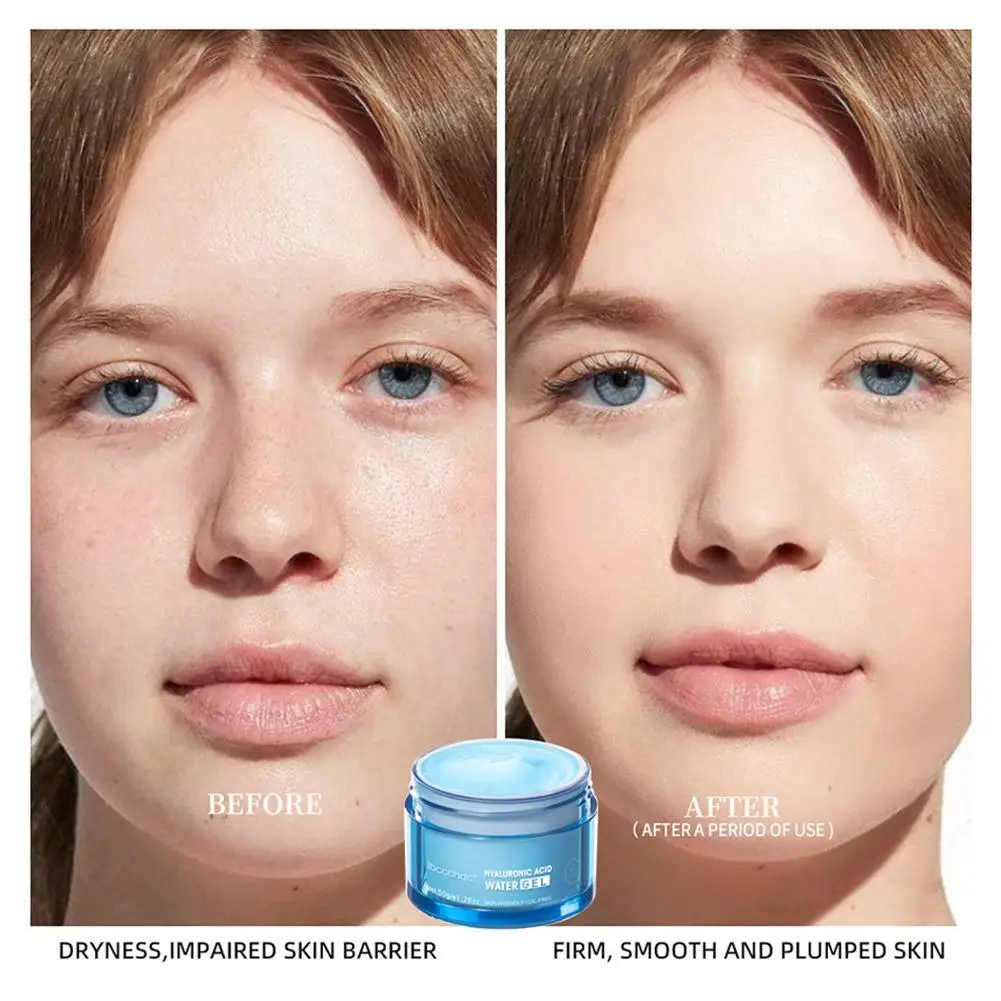 

50g Hyaluronic Acid Hydrating Water Gel Moisturizing Facial Cream Face Moisturizer For Dry Skin Improve Dryness Beauty Care S5V9