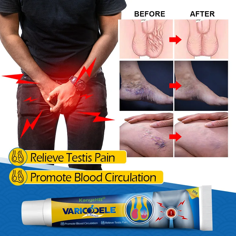 KanyeHB men's private vaginal ointment Maikang ointment earthworm leg vascular 20g male private ointment