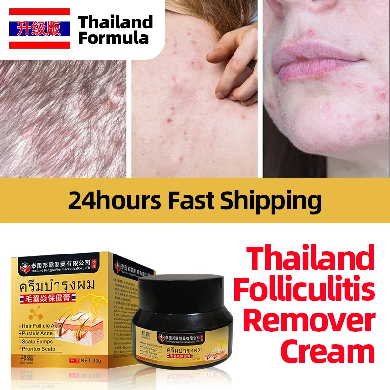 

Лечебный крем для фолликулита, средство для удаления кожи головы, искусственный дерматит, антибактериальное средство, Таиландская формула