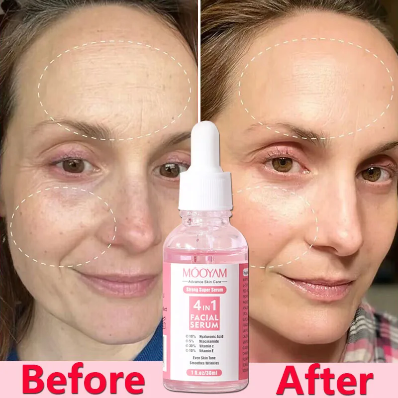 4 IN 1 Remove Wrinkles Face Serum Lifting Firming Fade Fine Lines Anti-Aging Essence Vitamin C Whitening Moist_voghion.com