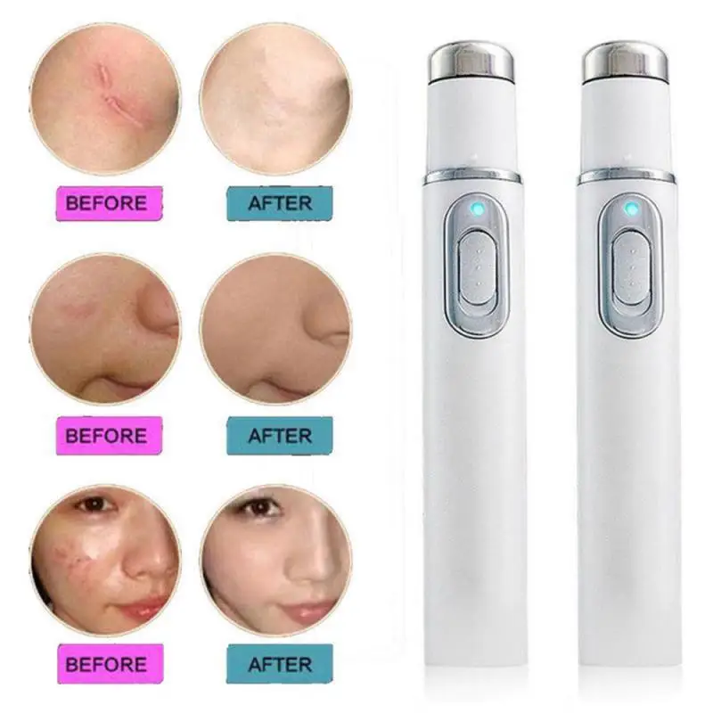 1~10PCS Eye Beauty Device 130 * 15mm Portable And Convenient Soothe Tired Eyes Improve Blood Circulation Reduce Dark Circles