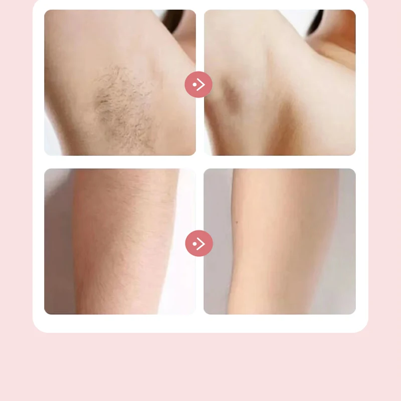 Electric Razor Image 16