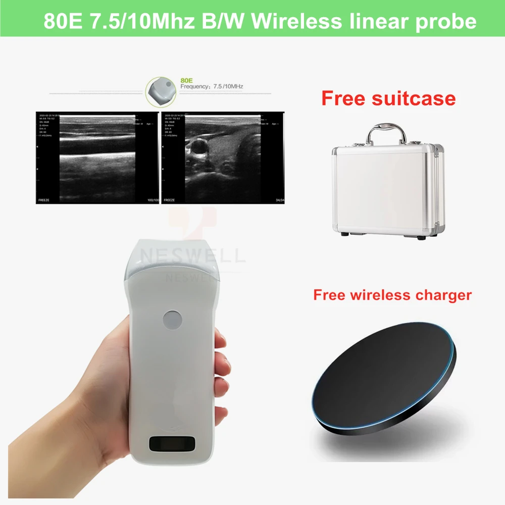 EagleView Portable Wireless Ultrasound Scanner with Linear, Convex and  Phased Array Probe. Compatible with iOS and Android.