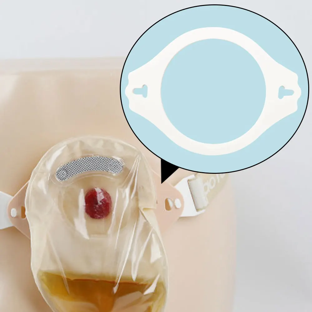 Ostomy Bag Reinforcement Stoma Leak-Proof Fixed Ring Buckle Style Belt Accessories
