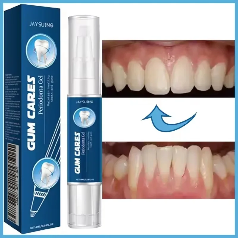 Gel de soin réparateur de gencives endommagées, soulage les gencives maléfiques, nettoyage en profondeur des dents, taches, sérum tartre, dentifrice pour caries dentaires