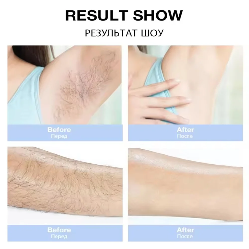 900000 Flashes Laser Epilator Instrume Permanent IPL Hair Removal Home Use Devices Ice Cool Painless Intense Pulsed Light